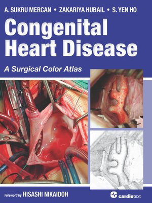 cover image of Congenital Heart Disease